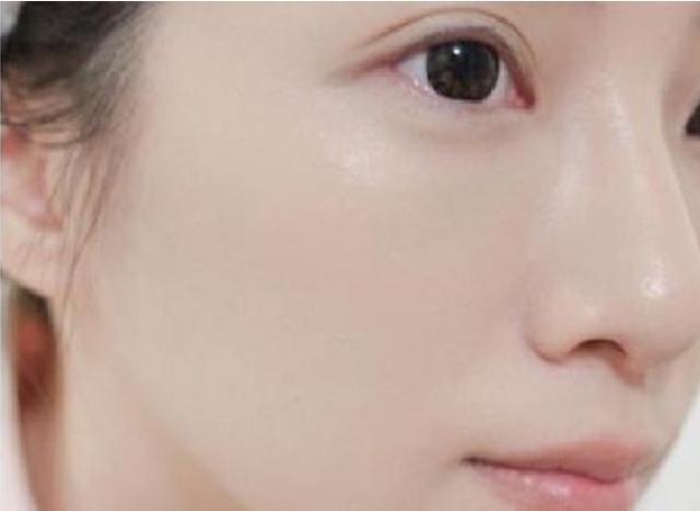 皮膚很粗糙是什么原因（皮膚為什么會粗糙該如何改善）(1)