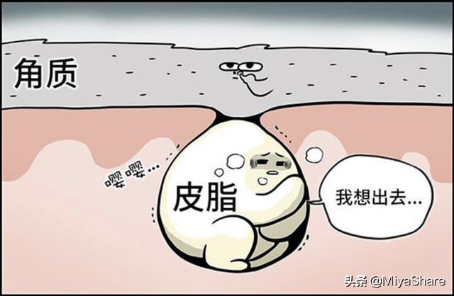 祛痘痘產(chǎn)品有哪些（8款平價祛痘產(chǎn)品推薦）(3)